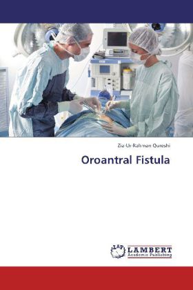 Produktbild: Qureshi, Z: Oroantral Fistula