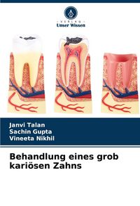 Produktbild: Behandlung eines grob kari&ouml;sen Zahns