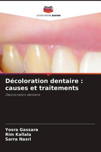 Produktbild: D&eacute;coloration dentaire : causes et traitements