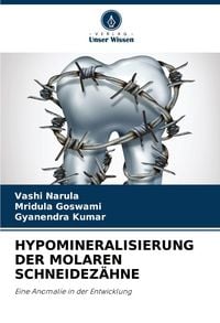 Produktbild: Hypomineralisierung der Molaren Schneidez&auml;hne