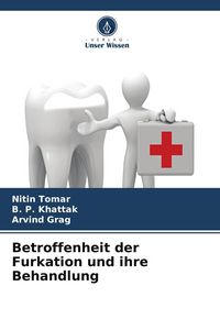 Produktbild: Betroffenheit der Furkation und ihre Behandlung