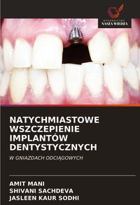 Produktbild: Natychmiastowe Wszczepienie Implant&oacute;w Dentystycznych