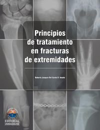 Produktbild: Principios de tratamiento en fracturas de extremidades