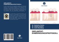 Produktbild: Implantat-Einbringungsprotokoll