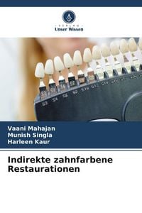 Produktbild: Indirekte zahnfarbene Restaurationen