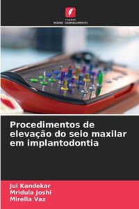Produktbild: Procedimentos de eleva&ccedil;&atilde;o do seio maxilar em implantodontia