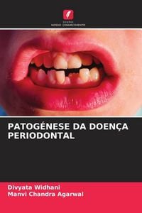 Produktbild: Patog&eacute;nese Da Doen&ccedil;a Periodontal