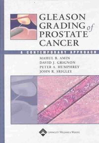 Produktbild: Gleason Grading of Prostate Cancer: A Contemporary Approach