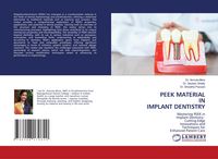 Produktbild: Peek Material in Implant Dentistry