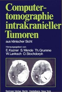 Produktbild: Computertomographie intrakranieller Tumoren aus klinischer Sicht