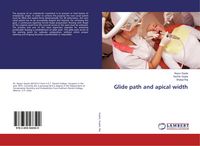Produktbild: Glide path and apical width