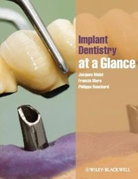 Produktbild: Implant Dentistry at a Glance