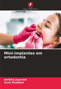 Produktbild: Mini-implantes em ortodontia
