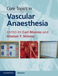 Produktbild: Core Topics in Vascular Anaesthesia