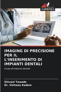 Produktbild: Imaging Di Precisione Per Il L'inserimento Di Impianti Dentali