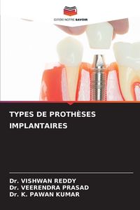 Produktbild: Types De Proth&egrave;ses Implantaires