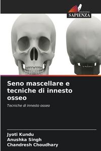 Produktbild: Seno mascellare e tecniche di innesto osseo