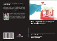 Produktbild: Les implants dentaires et leurs structures