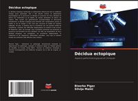 Produktbild: D&eacute;cidua ectopique