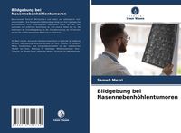 Produktbild: Bildgebung bei Nasennebenh&ouml;hlentumoren