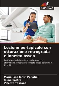 Produktbild: Lesione periapicale con otturazione retrograda e innesto osseo