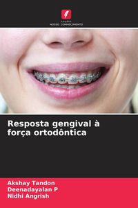 Produktbild: Resposta gengival &agrave; for&ccedil;a ortod&ocirc;ntica