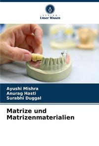Produktbild: Matrize und Matrizenmaterialien
