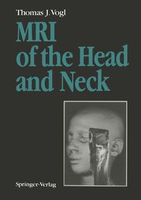 Produktbild: MRI of the Head and Neck
