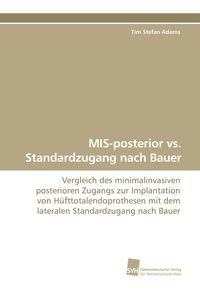 Produktbild: MIS-posterior vs. Standardzugang nach Bauer