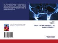 Produktbild: Sinus Lift Procedures in Implantology