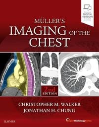 Produktbild: Muller's Imaging of the Chest