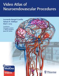 Produktbild: Video Atlas of Neuroendovascular Procedures