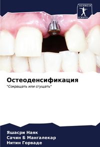 Produktbild: Osteodensifikaciq