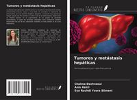 Produktbild: Tumores y met&aacute;stasis hep&aacute;ticas