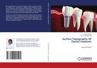 Produktbild: Surface Topography Of Dental Implants
