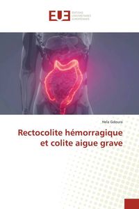 Produktbild: Rectocolite h&eacute;morragique et colite aigue grave