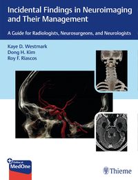 Produktbild: Incidental Findings in Neuroimaging and Their Management