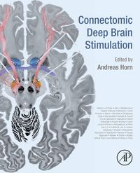 Produktbild: Connectomic Deep Brain Stimulation