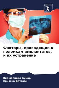 Produktbild: Faktory, priwodqschie k polomkam implantatow, i ih ustranenie