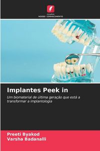 Produktbild: Implantes Peek in