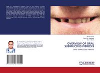 Produktbild: Overview Of Oral Submucous Fibrosis