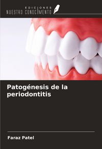 Produktbild: Patog&eacute;nesis de la periodontitis