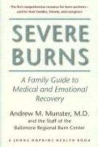 Produktbild: Severe Burns
