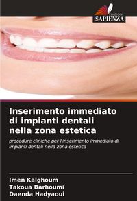 Produktbild: Inserimento immediato di impianti dentali nella zona estetica