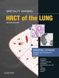 Produktbild: Specialty Imaging: HRCT of the Lung E-Book