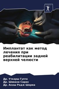 Produktbild: Implantat kak metod lecheniq pri reabilitacii zadnej werhnej chel&uuml;sti