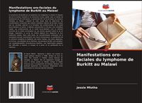 Produktbild: Manifestations oro-faciales du lymphome de Burkitt au Malawi