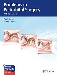 Produktbild: Problems in Periorbital Surgery