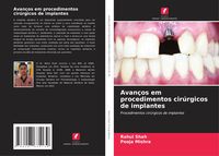 Produktbild: Avan&ccedil;os em procedimentos cir&uacute;rgicos de implantes