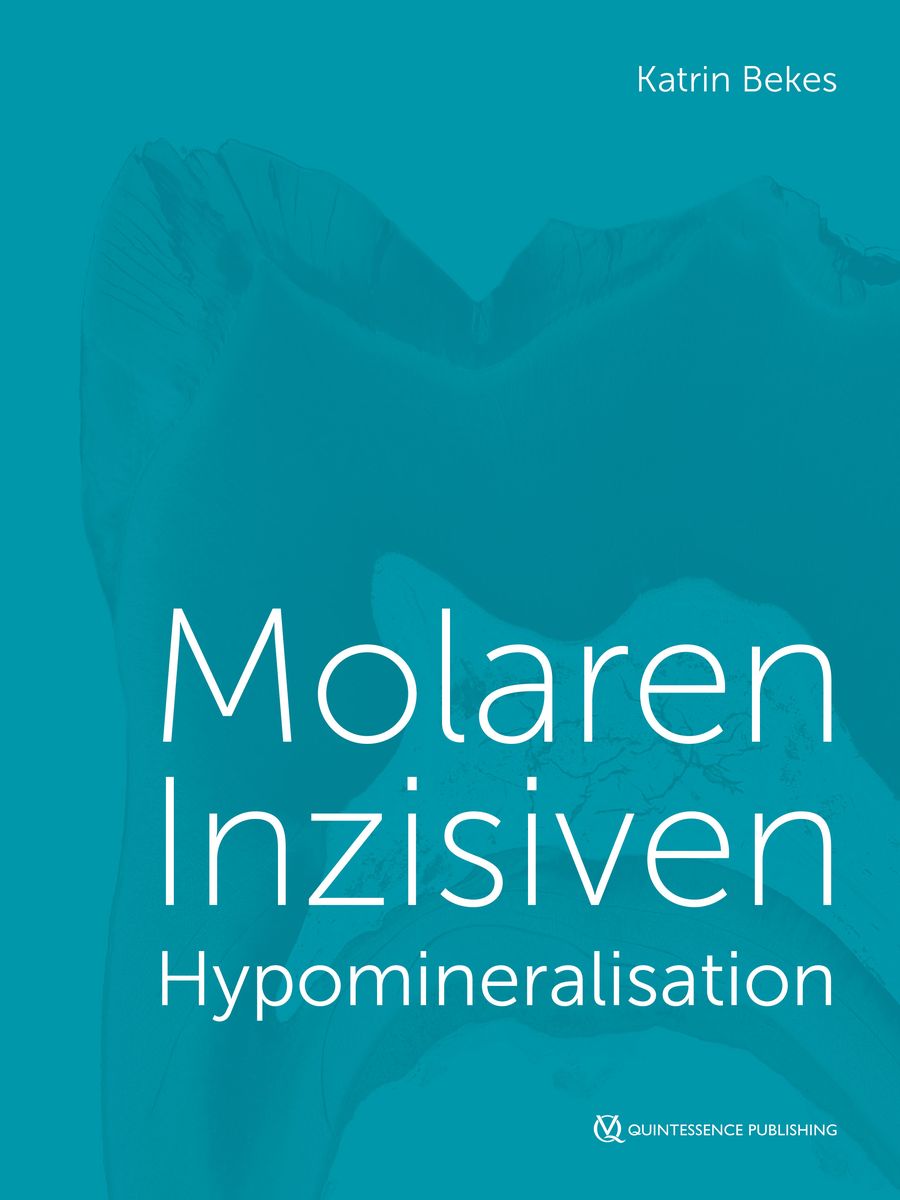 molaren-inzisiven-hypomineralisation-von-katrin-bekes-buch-978